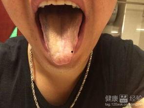 吃瓜后舌头黑什么原因,吃瓜后舌头变黑之谜